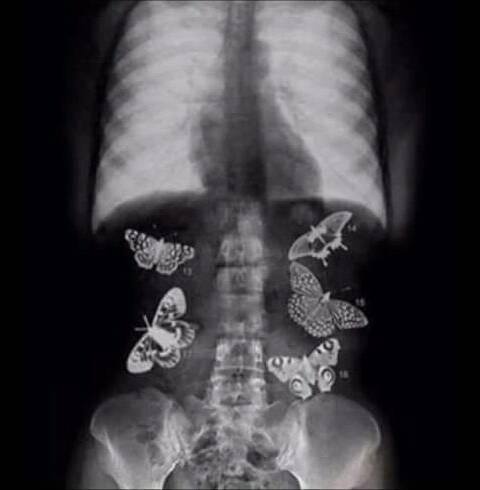  Filmy dla dzieci - motylki w brzuchu.jpg