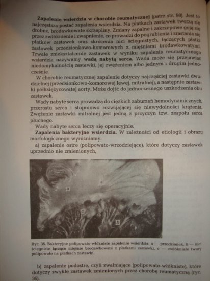 patologia_ukl_krazenia - DSC08423.JPG