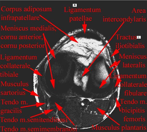 anatomia radiologiczna - 15.jpg