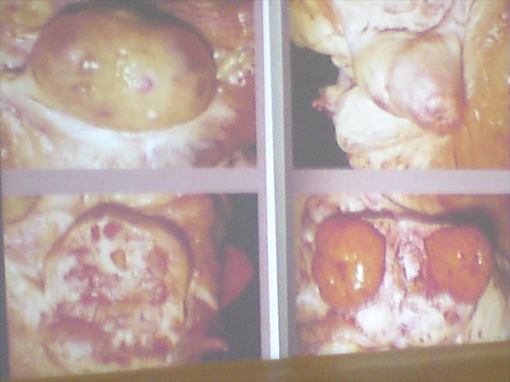 Badanie per rectum zdjęcia - DSC00354.JPG